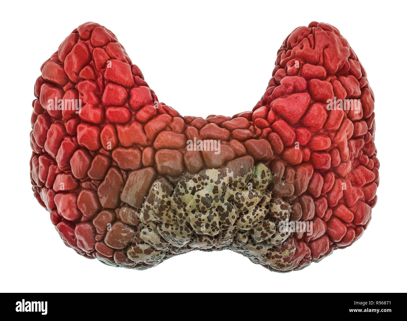 Schilddrüsenerkrankung Konzept, 3D-Rendering auf weißem Hintergrund Stockfoto