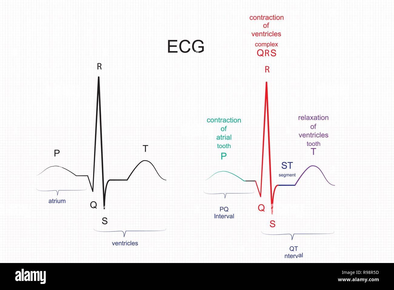 Ekg linie Ausgeschnittene Stockfotos und bilder Seite 2 Alamy