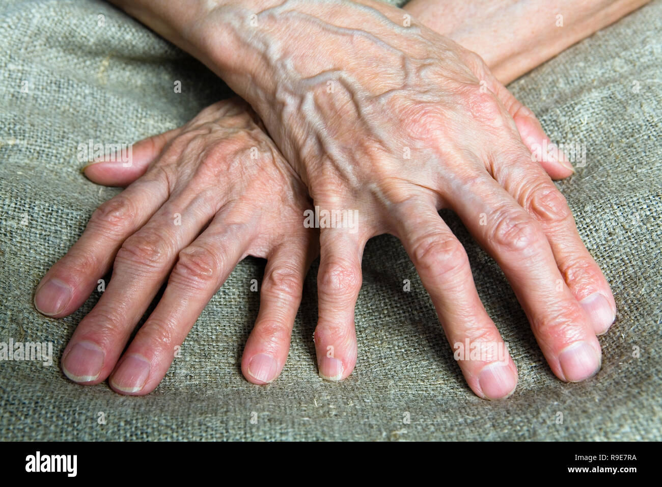 Die faltigen Hände einer alten Frau. Teil des Körpers. Stockfoto