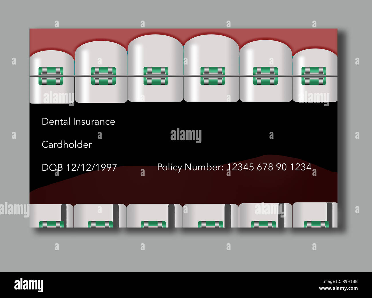 Hier ist eine Zahnversicherung ID-Card mit Zähnen und Klammern in das Design. Es ist eine Illustration. Stockfoto