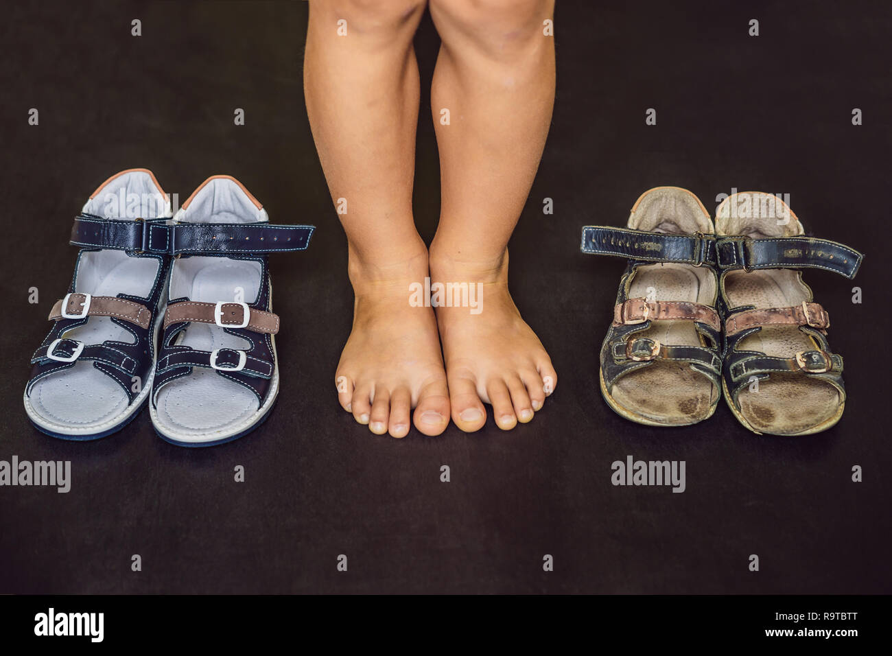 Orthopädische der Alten und Neuen Kinder Schuhe. Thomas Heel, Arch Support Stockfoto