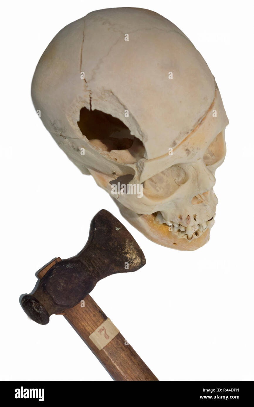 Großes Loch in der ermordeten Opfer Schädel mit einem Hammer zertrümmert, stumpf Mordwaffe gegen den weißen Hintergrund Stockfoto
