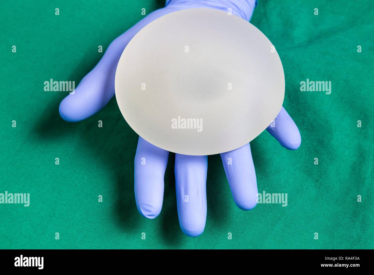 Silikon Brust Implantat, für die Erweiterung der eine weibliche Brust, Deutschland Stockfoto