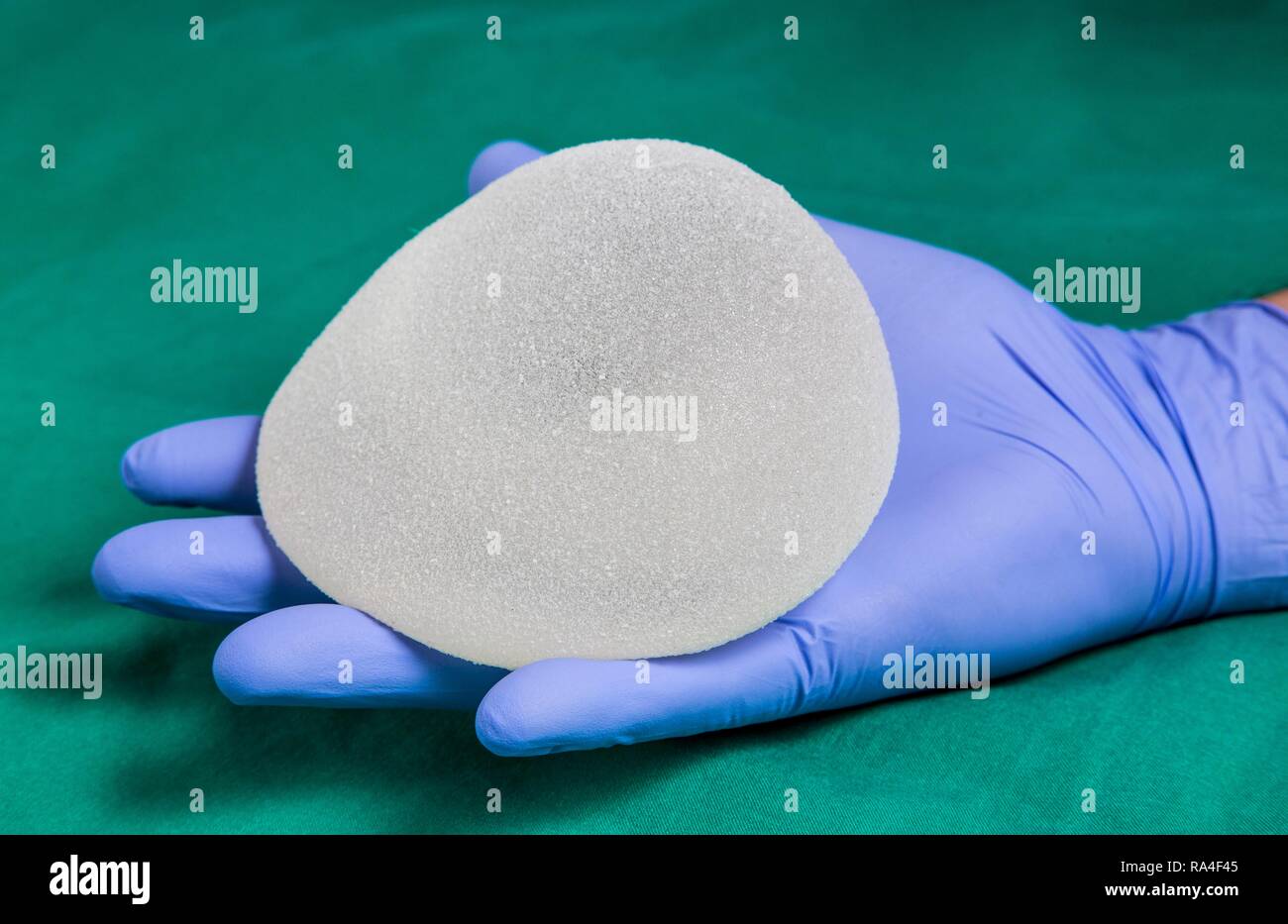 Silikon Brust Implantat, für die Erweiterung der eine weibliche Brust, Deutschland Stockfoto