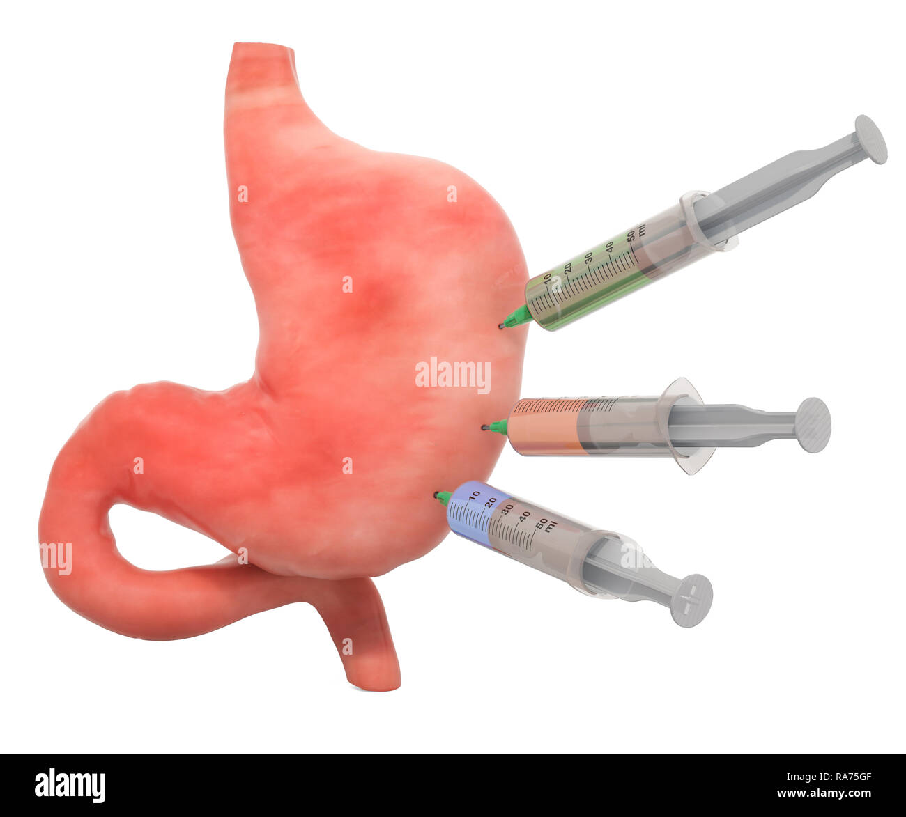 Behandlung und Arzneimittel für Magen Krankheit Konzept, 3D-Rendering auf weißem Hintergrund Stockfoto