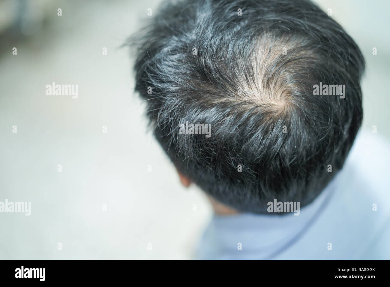 Fett in der Mitte den Kopf verlieren und beginnen Sie kein Haar von Reifen Asian Business Smart Active office Mann. Stockfoto