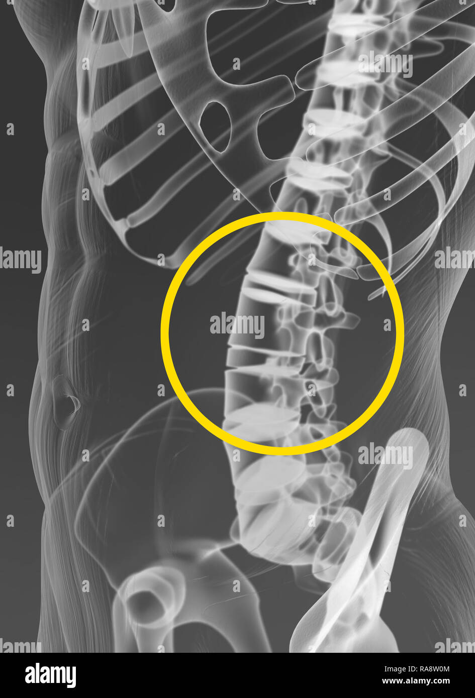 Vertebrale gemeinsame, Medizinisch 3D Artwork, x-ray anzeigen Stockfoto