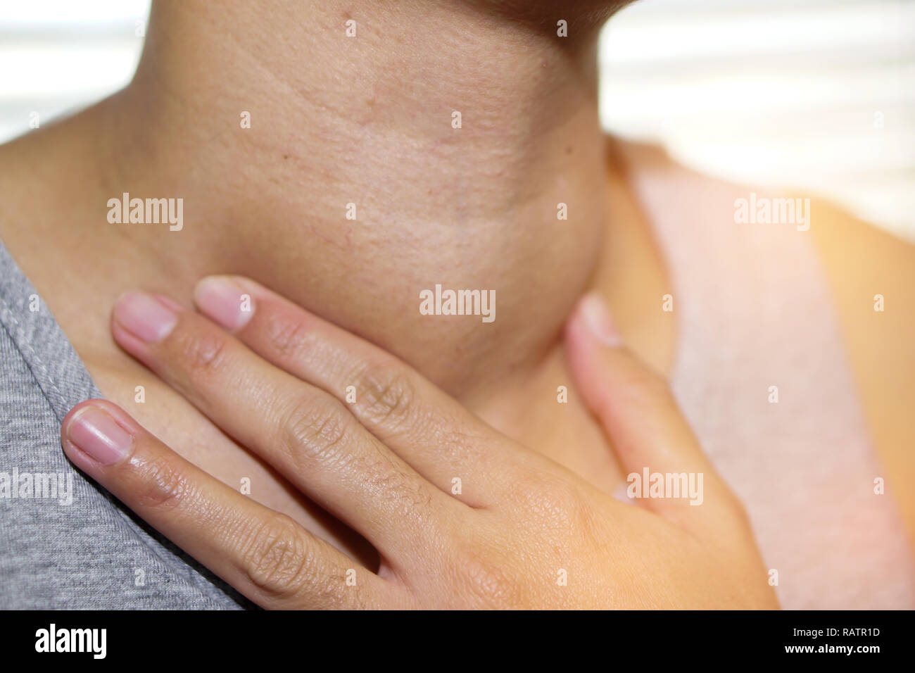Asiatische Dame Frau Patienten abnorme Vergrößerung der Schilddrüse Hyperthyreose (Überfunktion der Schilddrüse) an der Kehle: Gesunde starke Medizinische anhand von quantitativen Simulatio Stockfoto