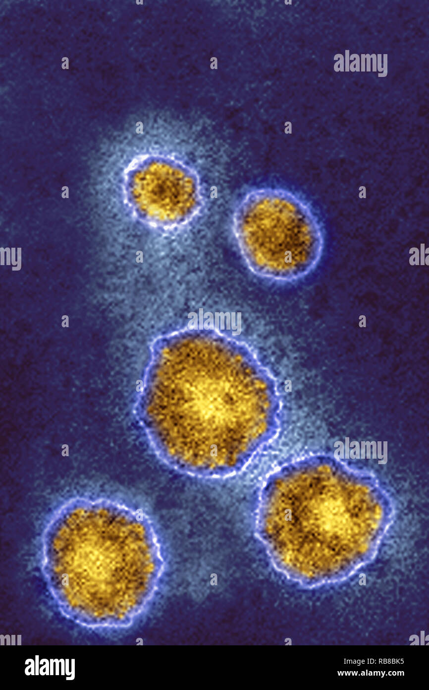 Myxovirus parotidis Fotos und Bildmaterial in hoher Auflösung Alamy