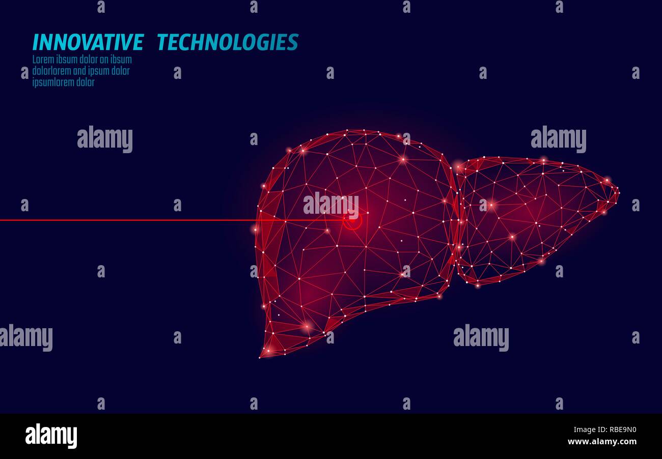 Menschliche Leber Laser Chirurgie operation Low Poly. Medizin Krankheit medikamentöse Behandlung schmerzhaft. Rote Dreiecke polygonale 3D-Render Form. Apotheke hepatitis Krebs template Vector Illustration Stock Vektor