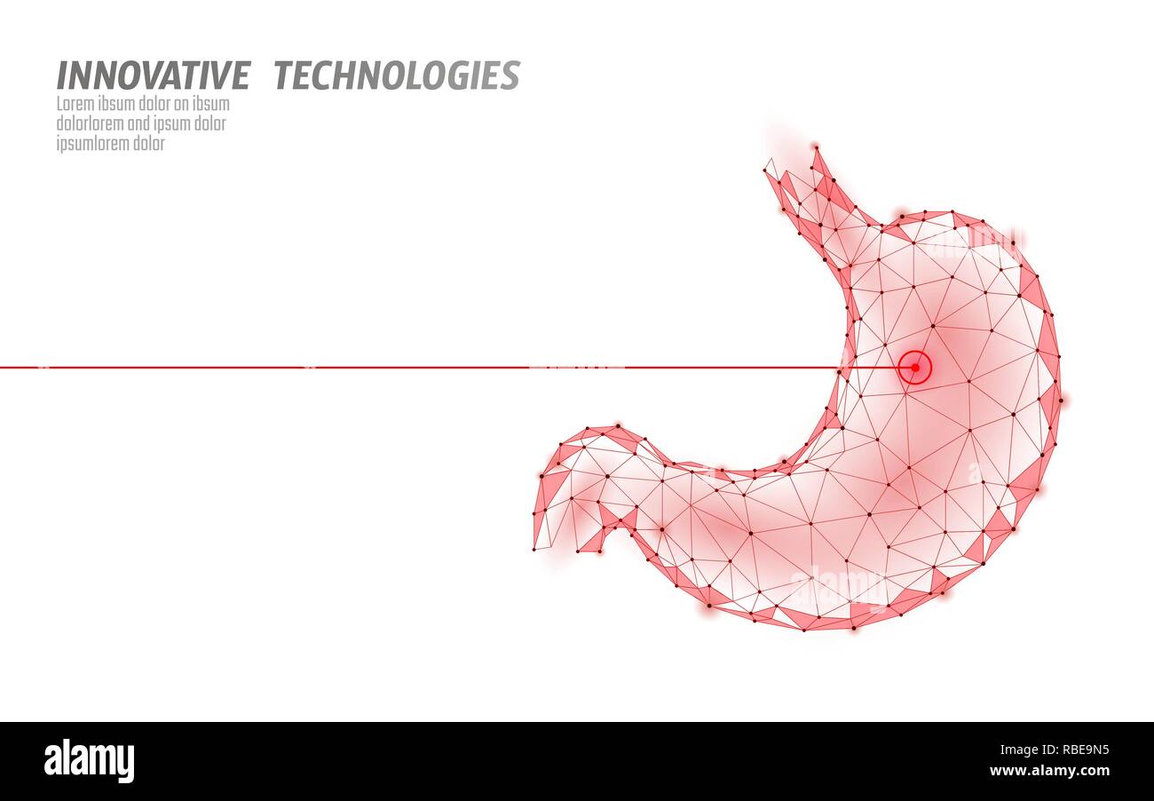 Menschlichen magen Laser Chirurgie operation Low Poly. Medizin Krankheit medikamentöse Behandlung schmerzhaft. Rote Dreiecke polygonale 3D-Render Form. Apotheke business Poster template Vector Illustration Stock Vektor