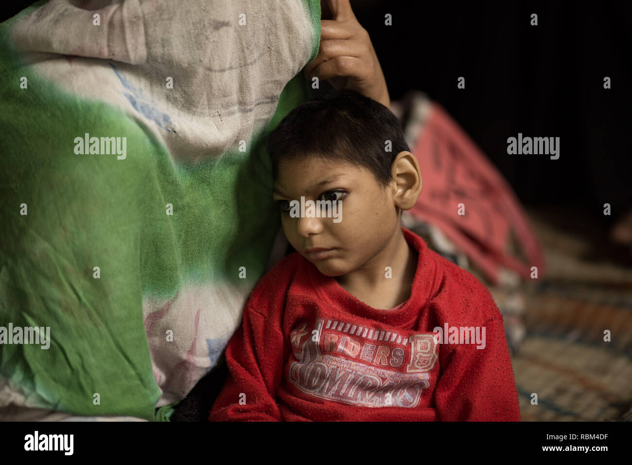 Indien. 7 Mär, 2017. Ein Kind gesehen an chingari Rehabilitation Centre. Chingari kümmert sich um die Opfer von Bhopal Gas Katastrophe. Die Bhopal Gas Katastrophe ein gasleck Incident wurde in der Nacht vom 2./3. Dezember 1984 bei der Union Carbide in Bhopal. Über 500.000 Menschen wurden in den toxischen Methylisocyanat (MIC) Gas ausgesetzt, wie sie schliefen. Die endgültige Zahl der Todesopfer ist Schätzungen zufolge zwischen 15.000 und 20.000. Credit: Ryan Ashcroft/SOPA Images/ZUMA Draht/Alamy leben Nachrichten Stockfoto