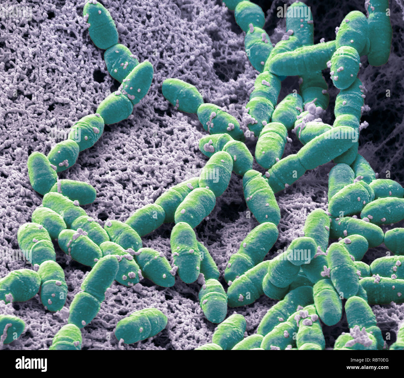 Streptococcus mutans. Farbige Scanning Electron Micrograph (SEM). S. mutans ist ein coccoid geformt, Gram-positiven, anaeroben Bakterien, ist Teil der Th Stockfoto