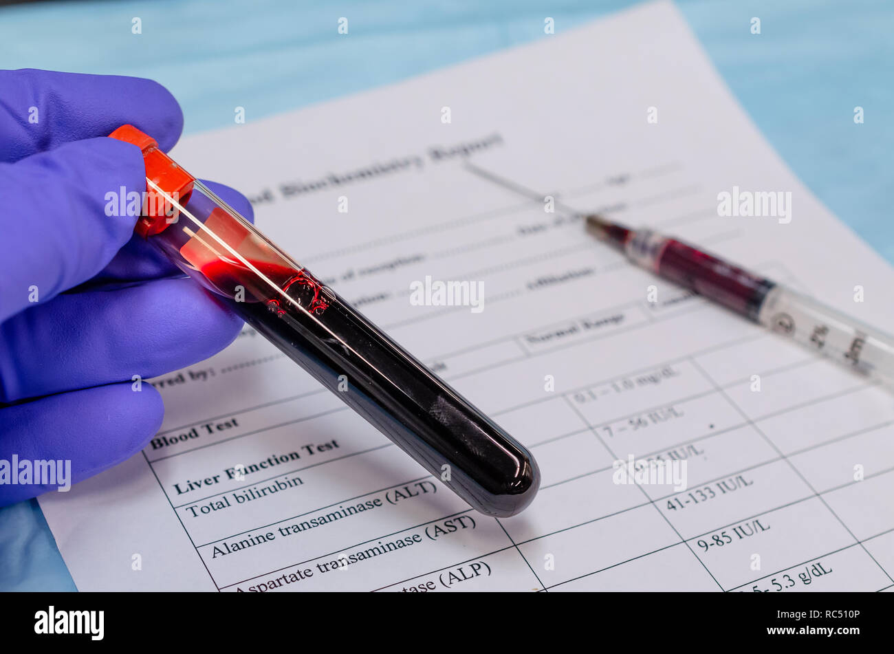 Blutentnahme zur Diagnose von Infektionskrankheiten und Blutpathologie Stockfoto