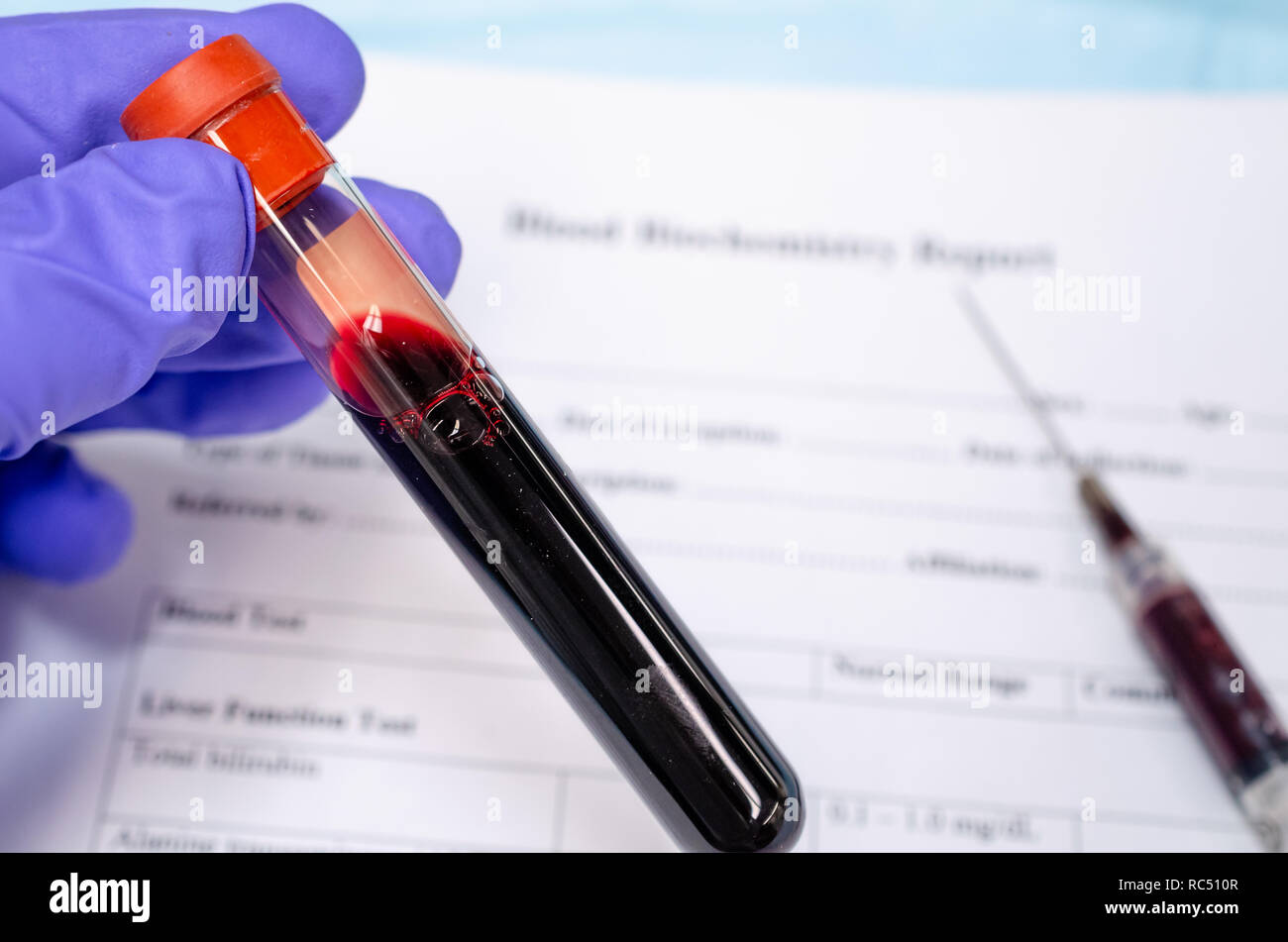 Blutentnahme zur Diagnose von Infektionskrankheiten und Blutpathologie Stockfoto