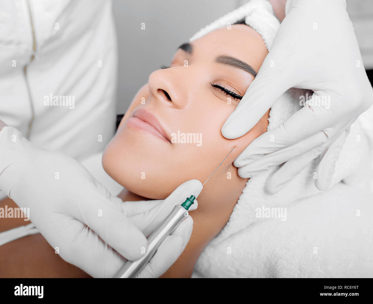 7/8-Frau Gesicht bekommen Facelift, Verfahren Lifting der Haut Stockfoto