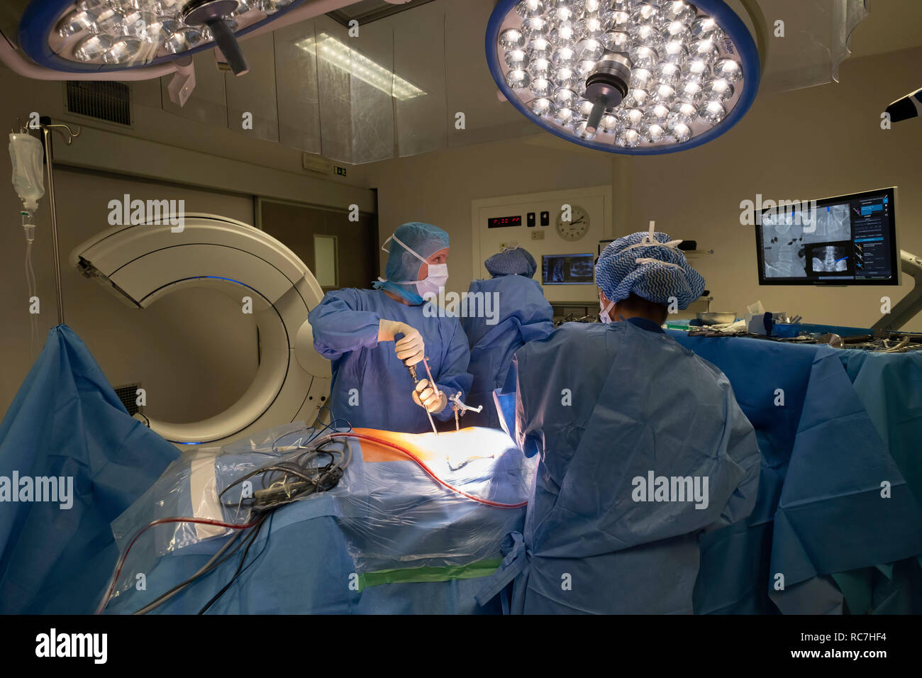 Ärzte betrachten die Neuronavigation computer-unterstützte Technologie system Bildschirm während der wirbelsäulenchirurgie Stockfoto