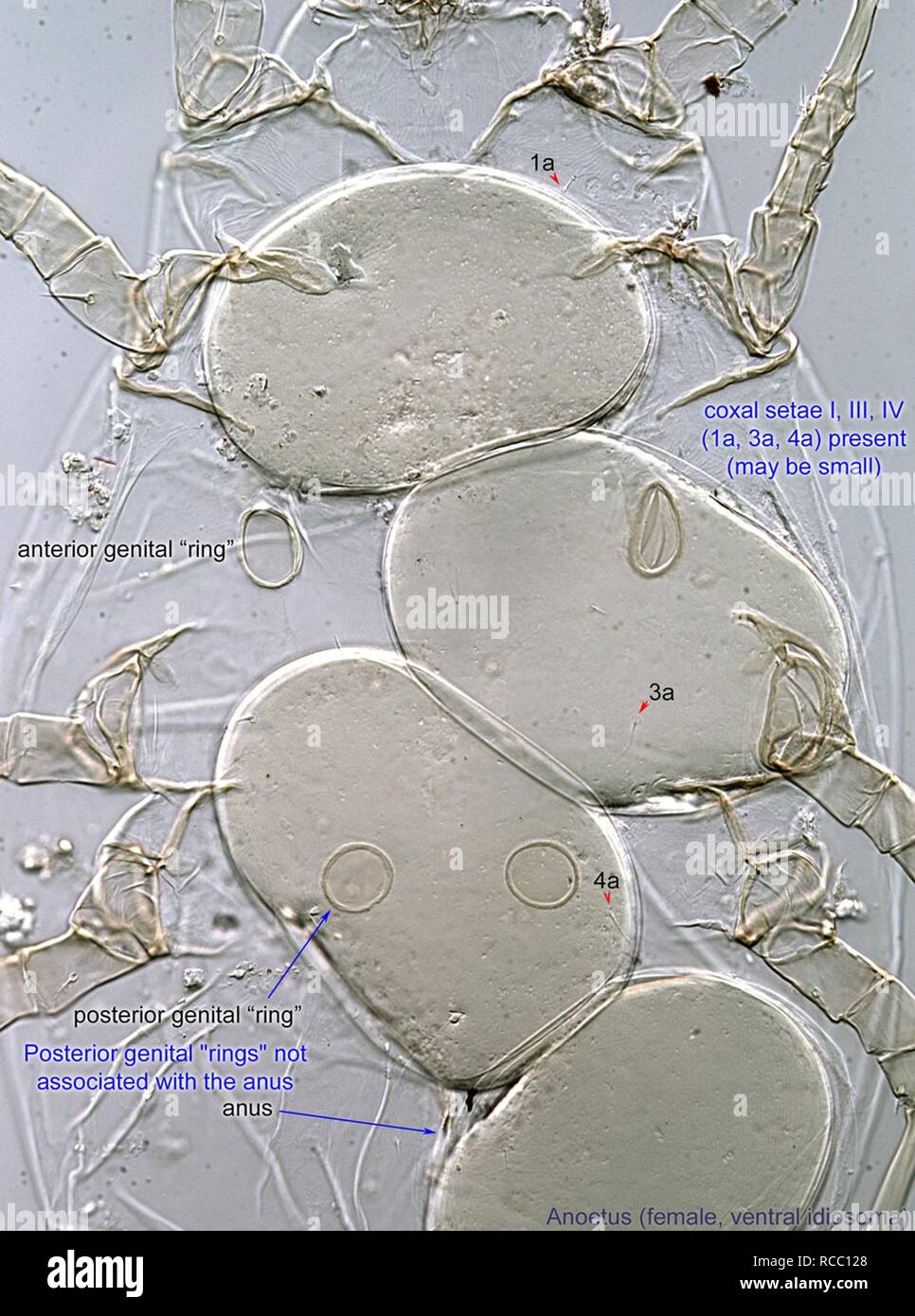 12-Anoetus weiblichen coxal Region ex Halictus ligatus BMOC 74-0807-001 C. Stockfoto