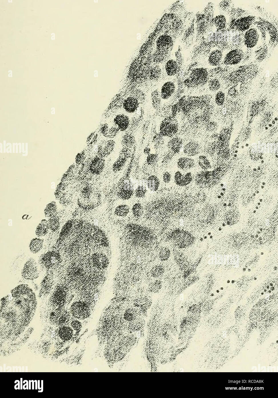 . Die Krankheiten und Störungen des Ochsen, mit Berücksichtigung der Krankheiten der Schafe. Platte HI. MICROCOCCUS SCAKLATINyE. ^?"<. "^^n Einige der oberflächlichen Hohlräume des Stratum Malpighii - ein. Runde Zellen Füllen der Kavitäten. h. Diplokokken und Streptokokken. Magnif. Stromversorgung über IIOO.. Bitte beachten Sie, dass diese Bilder sind von der gescannten Seite Bilder, die digital für die Lesbarkeit verbessert haben mögen - Färbung und Aussehen dieser Abbildungen können nicht perfekt dem Original ähneln. extrahiert. Gresswell, George; Gresswell, Albert. London, Allen Stockfoto
