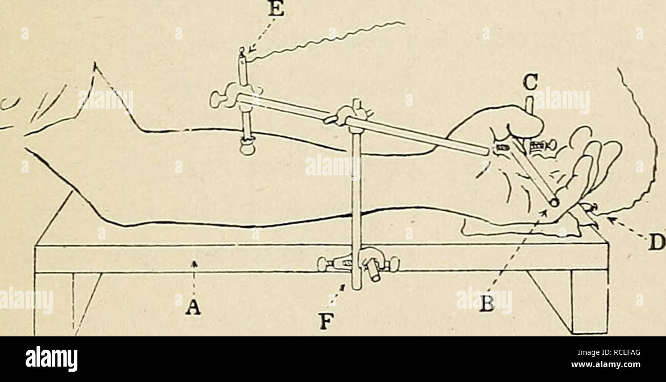 . Richtungen für die Arbeit im Labor in der Physiologie. Physiologie. Elektrische ERREGUNG DES MENSCHLICHEN MUSKELS. 71 EXPERIMENT XIV. Reaktion menschlicher Muskel zu trennen Induktion Schocks und zu einem Tetanizing Aktuelle. Benetzen Sie den linken Arm über den Motor Point für die flexor longus Pollicis, bind auf einer nassen Pad, und dann die AP-paratus arrangieren. Sehen, dass die Hände trocken in der Handhabung des appar sind - ATUS. Apparate. - Diese besteht aus einem arm rest, Registriergeräte, und die anregende Outfit im Experiment XIII. verwendet Die Armlehne ist auf dem Tisch, vor dem ein Thema ist, mit dem die Aufzeichnung appar platziert werden Stockfoto