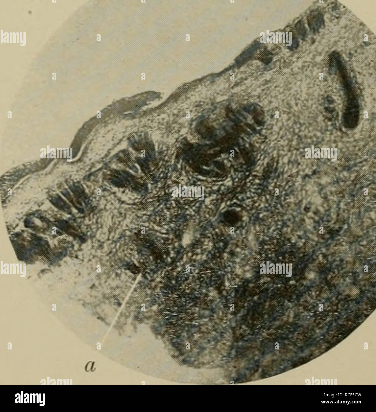 . Die vergleichende Pathologie der Haut. In: Veterinary; Haut. Hahn. Ergotismus. Beginnende Gangrän des Kammes. Eine starke Füllung der Gefäße, h Ballonierende Degeneration.. Kaninchen. Crotonöldermatitis, experimentell erzeugt, eine starke Fibrin-Ausscheidung. (Färbung nach Weigert.). Bitte beachten Sie, dass diese Bilder sind von der gescannten Seite Bilder, die digital für die Lesbarkeit verbessert haben mögen - Färbung und Aussehen dieser Abbildungen können nicht perfekt dem Original ähneln. extrahiert. Heller, Julius, 1864 -. Berlin: Hirschwald Stockfoto