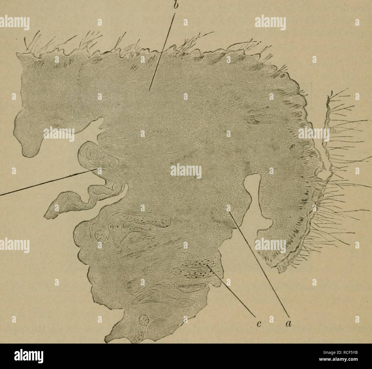 . Die vergleichende Pathologie der Haut. In: Veterinary; Haut. 106 Trophoneuiotische Ilaulerkrankuiigen. Kapitel, dass selbst eine kritisclic Uebersiclit über den Ixalimen inausgelit meines Themas J). Ich gebe nur Abbildungen eigener Beobachtungen, weil in ihnen der Nachweis der Erkrankung der Ilautnerven gelungen ist. Nach subkutaner Eigspritzung von Sublimat in sterben Glutaen von Kaninchen entstand schwere Polyneuritis mercurialis. Gleichzeitig entwickelte sich der Fußspitze Gangrän (Vgl. Abb. 10). Bei einem Ver-Fisur 11.. Schnitt durch ein bei experimenteller Polj - Neuritis mercurialis s Stockfoto