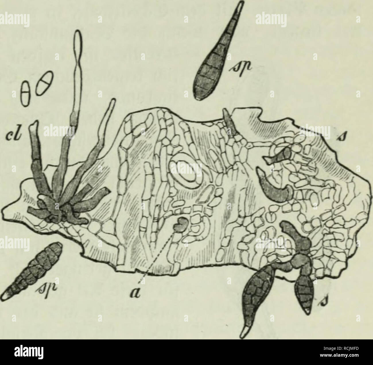 . Diesem Sterben der Pflanzen; ein Handbuch für Land- und Forstwirte, Gärtner, Gartenfreunde und Botaniker. Pflanzenkrankheiten. 13. Kapitel: Pjrenomycetps^ 99. artigen oliobraunen Über^ uge § bie SSonibienform Sporidesmium putre-fa c i e 11 s Ftukel. 3a c c a r b ü f) beii^ ilj in Clasterosporiuin putrefacieiis Sacc. umbenannt; inbes Ganj mit llnred) t, Benn ber 9 Rame Clasterosporiuin ift für biejenigen formen aufgefteUt morben, bereu Sporen nur £ luerfc^ eibe=radnbe [i^en, inä^ renb ber 3 ftübeupil 5 | et) r f^änfig aud) zus. ööngömaube in ben Sporen befiel, luas aI [o ber 6f) arafter uon Sporidesmi Stockfoto