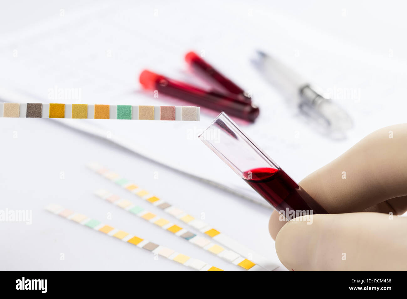 Röhrchen mit Blut auf weißen Tisch mit Test Chart und Kugelschreiber Stockfoto