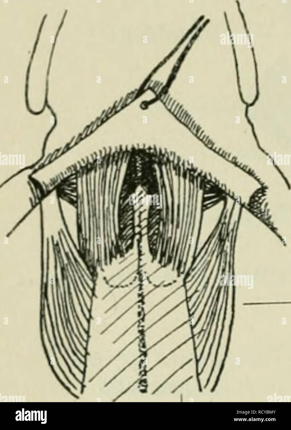 . Der Frosch; zugleich eine Einf in das praktische Studium des Wirbeltier-Krs. Frösche. 26 Abb. 12. Der auch von dem RÃ¼cken bis zum reclus Trizeps reicht. Vorn treten Ã ¤ hnhch wie auf der RÃ¼ckenseite quergelagerte Muskeln auf, welche Orig. Anlaj, 'onisten von jenen Sindh, das heiÃt, den durch die Dorsalen Muskeln gehobenen Arm / der Bauchseite fÃ¼hren oder nach hinten ziehen. Sie sind grÃ¶ Ãtenteils zwischen den Teilen des SchultergÃ¼rtels einerseits und den Arm-Lüneburg andererseits ausgespannt. Von hinten beginnend treffen wir drei Por-tionen des M. pectoralis, nÃ¤mlich eine Portio abdom Stockfoto