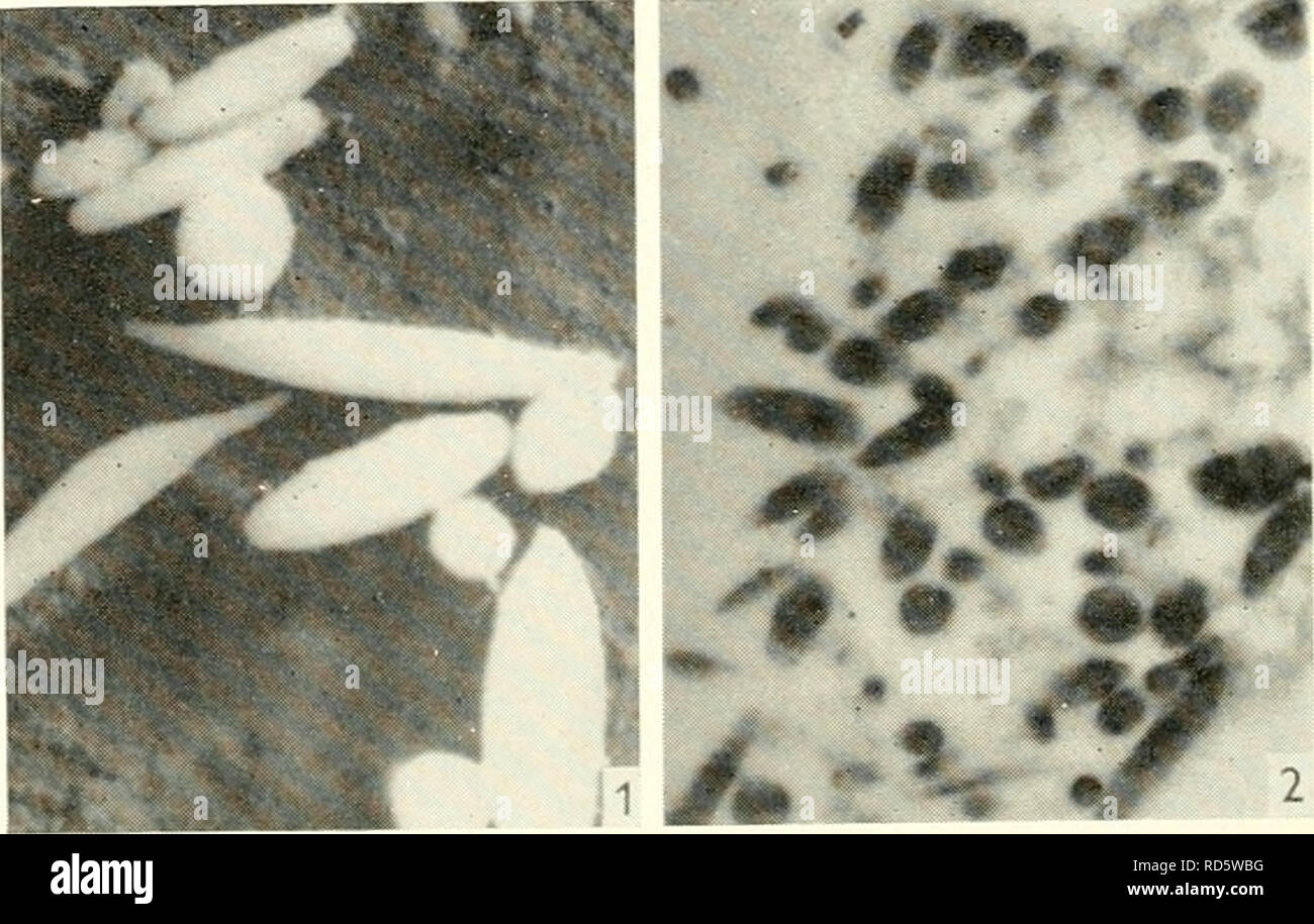 . Elektronenmikroskopie; Verfahren der Konferenz von Stockholm, September, 1956. Elektronenmikroskopie. 196 Referenzen G. LION, C. MÄRTENS UND G. VANDERMEERSSCHE 1. De Robertis, E./. Biophys. Biochem. Cytol. 2. 319 (1956). 2. De Robertis, E. und Franchi, C.M.,/. Biophys. Biochem. Cytol. 2, 307 (1956). 3. Sjostrand, F.S.,/. Zelle. Comp. Kurt von Figura. 33, 383 (1949). 4. - Ebd. 42, 15 (1953). 5. - Ebd. 42, 45 (1953). 6. - /. Appl. Phys. 24. 1422 (1953). 7. - Unveröffentlichte. 8. SvAETiCHiN, G., Acta Kurt von Figura. Scand. 39, Suppl. 134. 17^6 (1956). Submikroskopische Morphologie der Netzhaut Pigment Epitheli Stockfoto