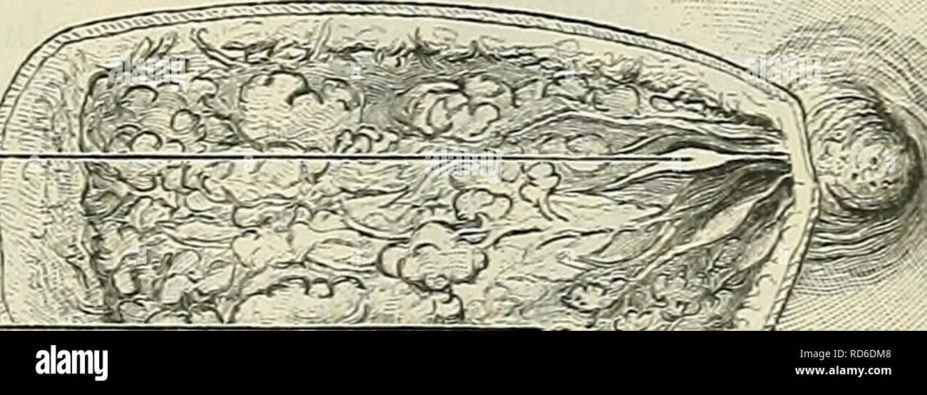 . Cunninghams Lehrbuch der Anatomie. Anatomie. Die MAMMAEY Drüsen. 1337 liegt auf der oberflächliche Aspekt des Pectoralis major und in geringerem Maße auf die serratus anterior Muskel. In der Nähe der Gipfel jedes Mammakarzinom Elevation, und in der Regel auf der Ebene der vierten oder fünften Rippe, ist die Warze-wie nijjple oder papilla Mammae, die durch die Öffnungen der Milchgänge durchbohrt wird und ist durch einen farbigen kreisförmige Fläche der Haut bezeichnet den Warzenhof umgeben. Die Haut, die den Nippel ist in zahlreichen Falten geworfen, und auf dem warzenhof Exponate viele Minute aufgerundet Projektionen aufgrund von Th Stockfoto