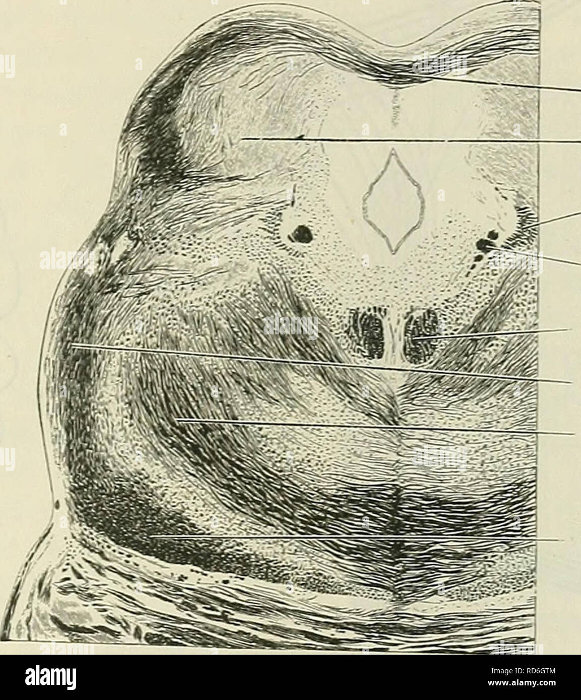 . Cunninghams Lehrbuch der Anatomie. Anatomie. Interne STRUKTUR DER MESENCEPHALON. 589 Decussating Fasern Kern von Inferior Colliculus Mesencephalic Wurzel der Tri - Trochlea geminal Nerv nerv Medial longitudinal bundle Seitliche lemniscus conjunctivum Brachium Medial lemniscus wichtige Funktionen dieser Ausrichtung ist zu binden diese Kerne und damit aktivieren Sie in Harmonie mit den anderen zu handeln. Fasern geben Sie auch die medialen longitudinalen Fasciculus aus der vestibular Nucleus des Hörnervs. Die Ergebnisse, die durch Degeneration erhalten würden, deuten darauf hin, dass zu einem großen Ex Stockfoto