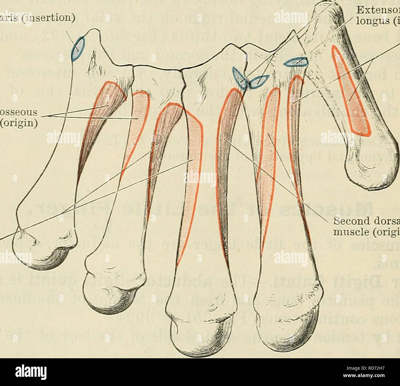 . Cunninghams Lehrbuch der Anatomie. Anatomie. Abb. 352.- Die ureas Interosseous Muskeln (rechte Seite). V1, zuerst; V2, zweite; und V 3, dritter Ureas interosseous Muskeln. Die Interosseous Muskeln. Die interosseous Muskeln der Hand die Räume zwischen den Mittelhandknochen besetzen. Sie sind in zwei Sets, ureas und dorsale angeordnet. Mm. Interossei Volares. - Die ureas (O.T. Palmar) interossei sind drei Extensor carpi Ulnaris (Insertion) Vierte dorsal interosseous Muskel (Ursprung) dritte Dorsalen inter-knöchernen Muskel (Ursprung). Extensor carpi radialis Brevis (Insertion) Extensor carpi radialis longus (ins Stockfoto