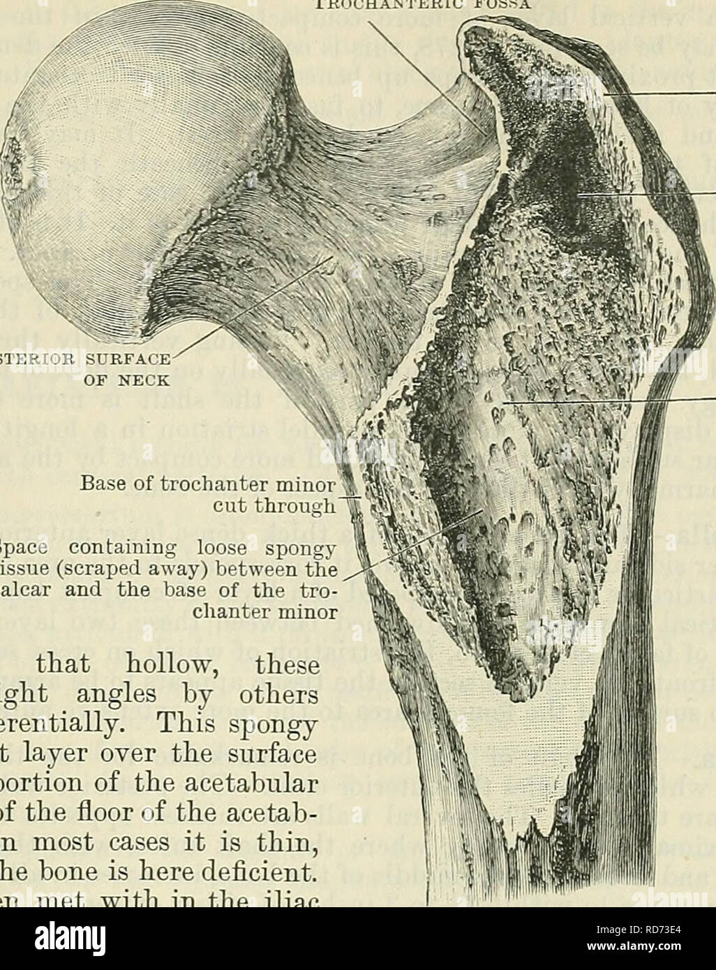 Trochanter Major Stockfotos & Trochanter Major Bilder Alamy