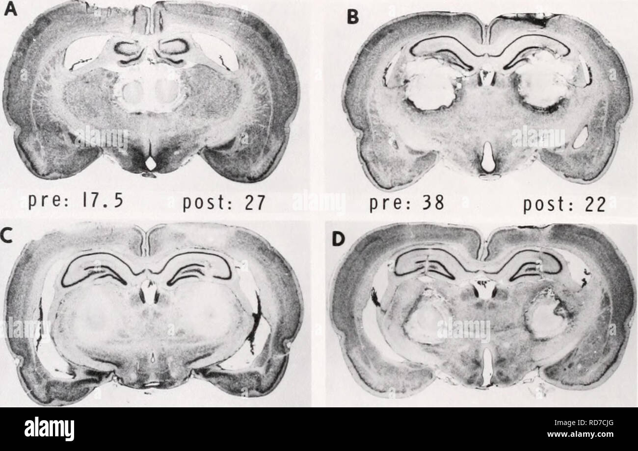 . Eine elektroenzephalographischen und neuroanatomische Analyse der septal-Syndrom. Gehirn; Behaviorismus (Psychologie); Hypothalamus; Ratten. -25-. pre: 36,5 Post: 35,5 Pre: 29 Post: 5.5. Bitte beachten Sie, dass diese Bilder sind von der gescannten Seite Bilder, die digital für die Lesbarkeit verbessert haben mögen - Färbung und Aussehen dieser Abbildungen können nicht perfekt dem Original ähneln. extrahiert. Turner, Blair Hamilton, 1938 -. Stockfoto
