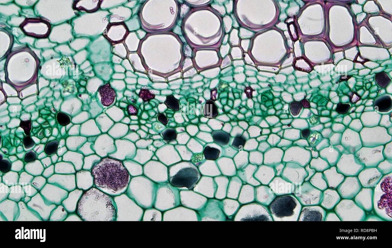 Angiospermen Morphologie Cytoliths in Ficus Leitbündel (35741365004). Stockfoto