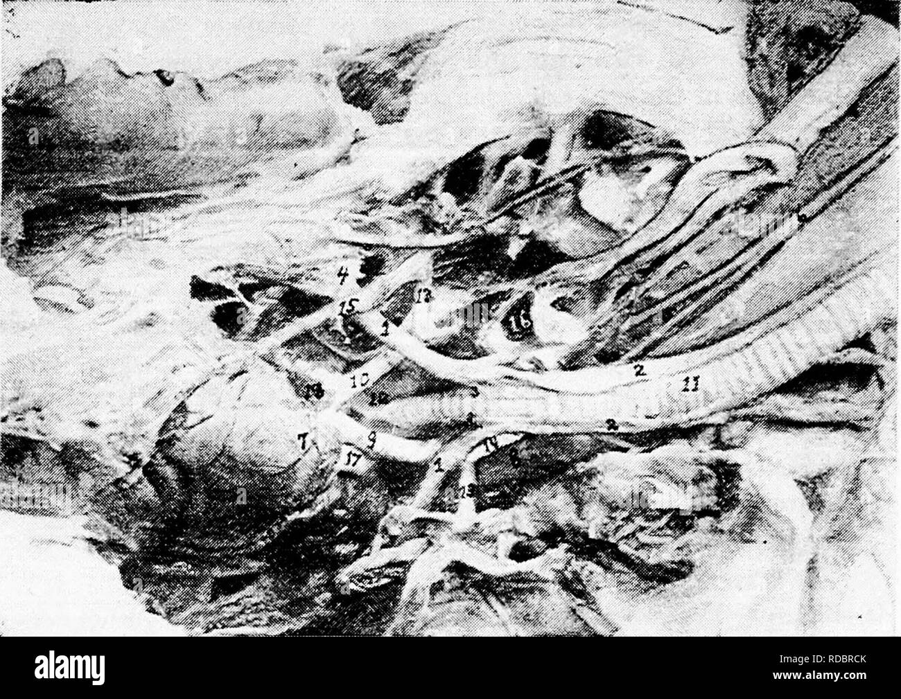 . Die Anatomie der Haushühner. Heimische Tiere; Veterinärmedizin; Geflügel. Abb. 20.- Der Anterioren pektorale Region, i, Stemo - trachealis. 2, Tracheo-Lateralis. 3, Broncho-trachealis Brevis. 4, Costal Prozess des Brustbeins. 5 Mit der rechten und linken Halsschlagader konvergierenden und Besetzen gleichen Ummantelung bei 6. 7, das Herz, die Zweigniederlassungen der Koronararterie. 8, HWS-sac. 9, Left'? Brachio-Cephalen Arterie. 10, Rechts brachio-Cephalen Arterie. 11, Luftröhre. 12, inf Kehlkopf. 13, A. subclavia. 14, Halsschlagader Stamm. 15, Interne thorakale Arterie. 16 Schilddrüse. 17, Anterior Vena cava. 18, Congelador Stockfoto