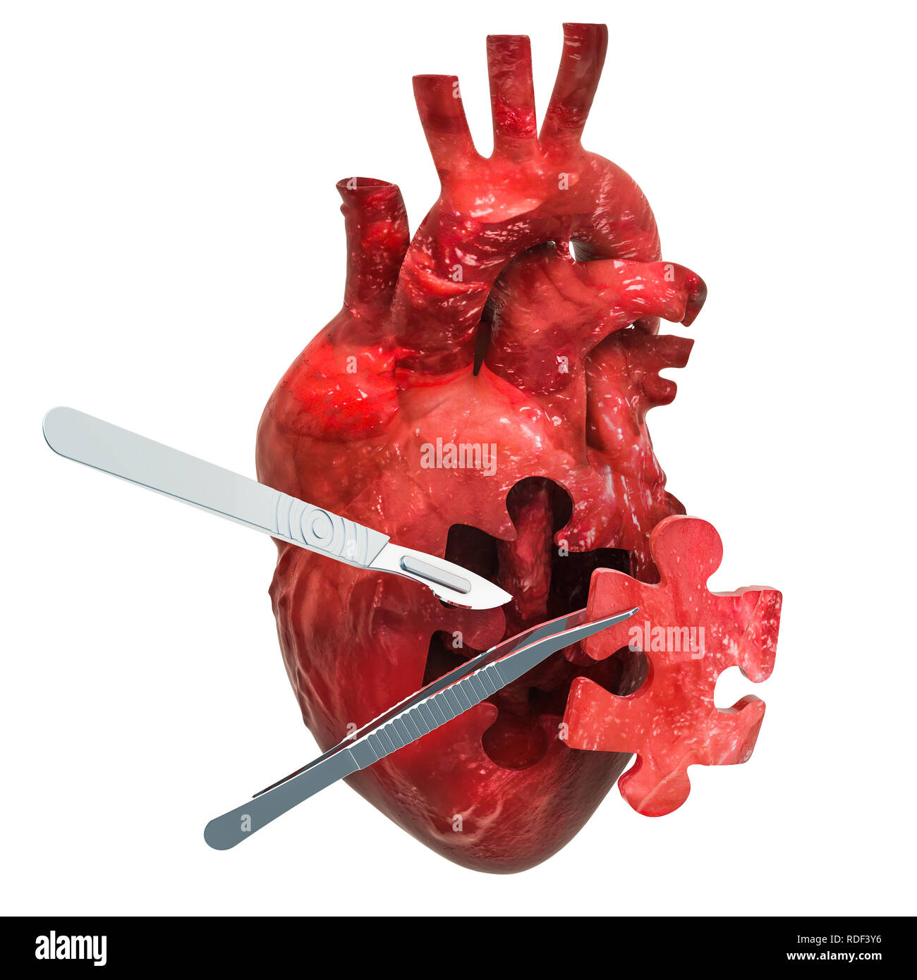 Herzchirurgie Konzept, 3D-Rendering Stockfoto