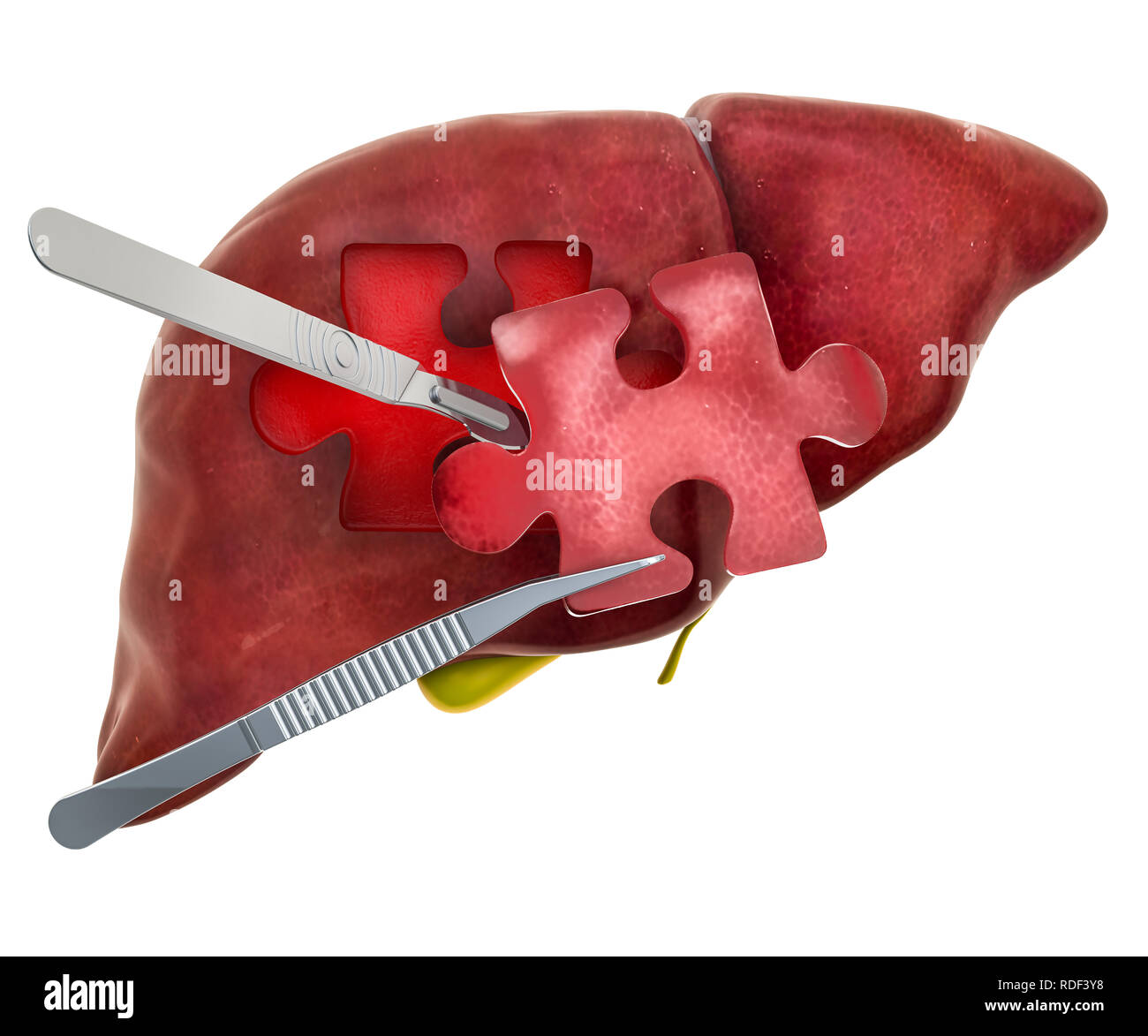 Leber und Gallenblase Chirurgie Konzept, 3D-Rendering auf weißem Hintergrund Stockfoto
