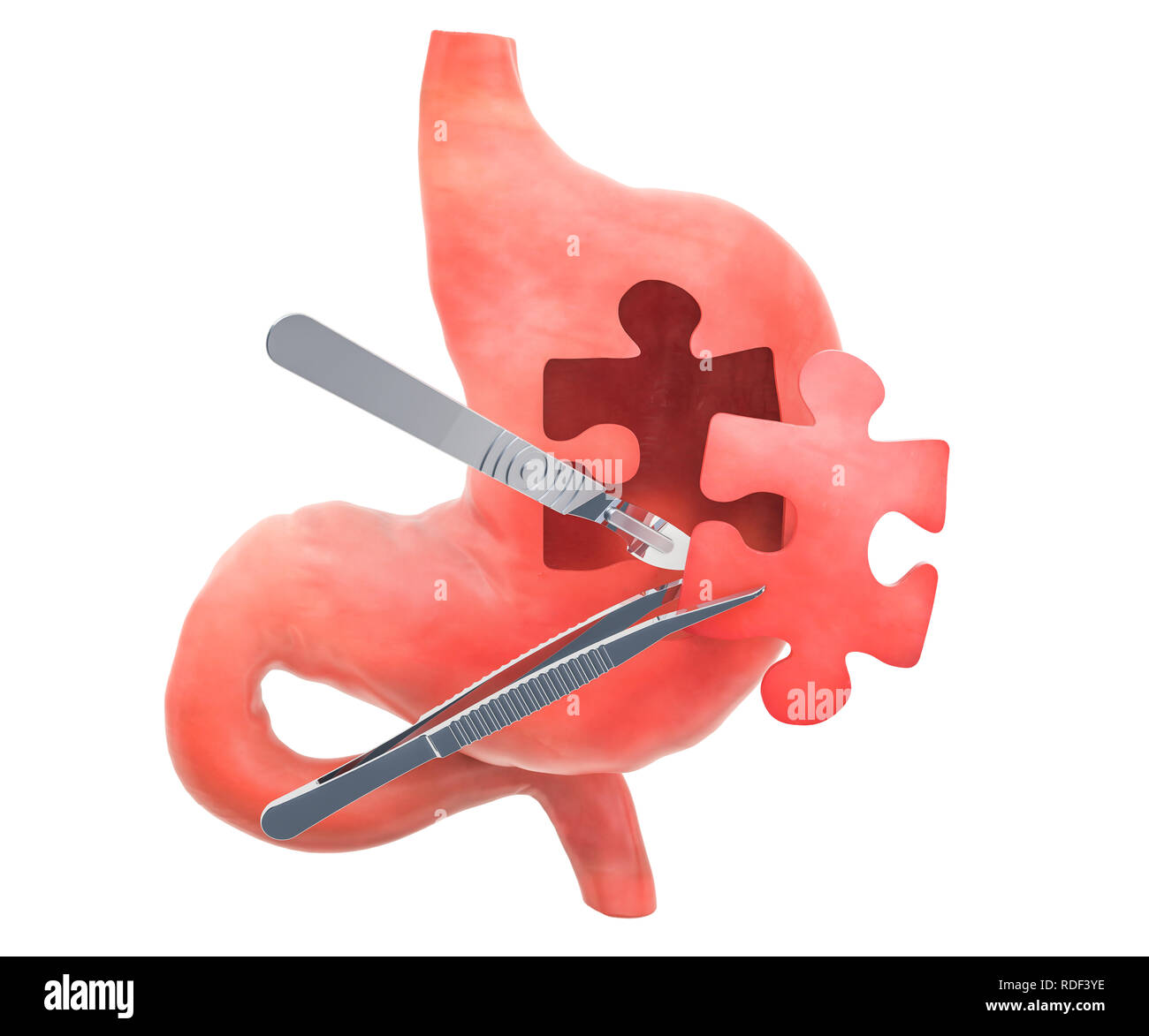 Magenchirurgie Konzept, 3D-Rendering auf weißem Hintergrund Stockfoto