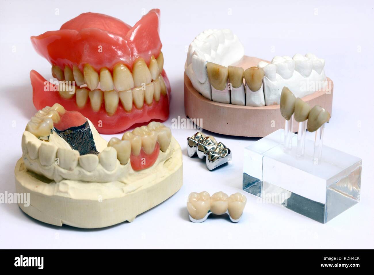 Dental Labor, Herstellung von Zahnersatz durch ein Handwerksmeister, komplette Prothese, hinten links, ausziehbare Krone Stockfoto