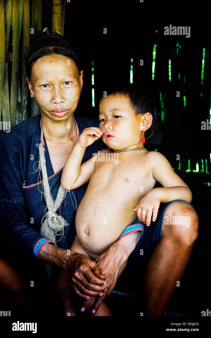 Luang Namta/Laos - JUL 06 2011: Lanten Stammes- Mitglied Frau mit ihrem Kind aus dem nördlichen Teil des Landes mit Silber Halskette Stockfoto