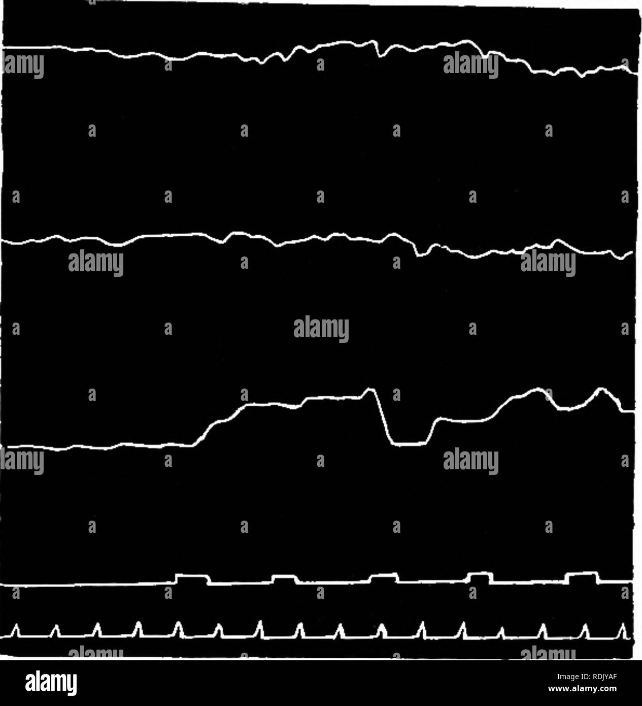 . Clevere Hans (das Pferd von Herrn Von Osten) ein Beitrag zur experimentellen tierischen und menschlichen Psychologie. Tierische Intelligenz; Tier Ausbildung; Pferde; Psychologie, Vergleichende. Laboruntersuchungen 129 endgültige Zahl gibt einen heftigen Ruck des Kopfes, nach oben. Die Aufmerksamkeit, die hier als der Typ III, der auf Seite 94 beschriebenen charakterisiert werden. (Aufgrund von Platzmangel ist es unmöglich ein Beispiel für Typ II, die nur bei sehr großen Zahlen zu finden.) Abbildung 9 (von allesch) ist Ausdruck des sehr zu geben, sondern nach Aussage der Introspektion des Subjekts - nicht wirtschaftliche Konzentration. Respira Stockfoto