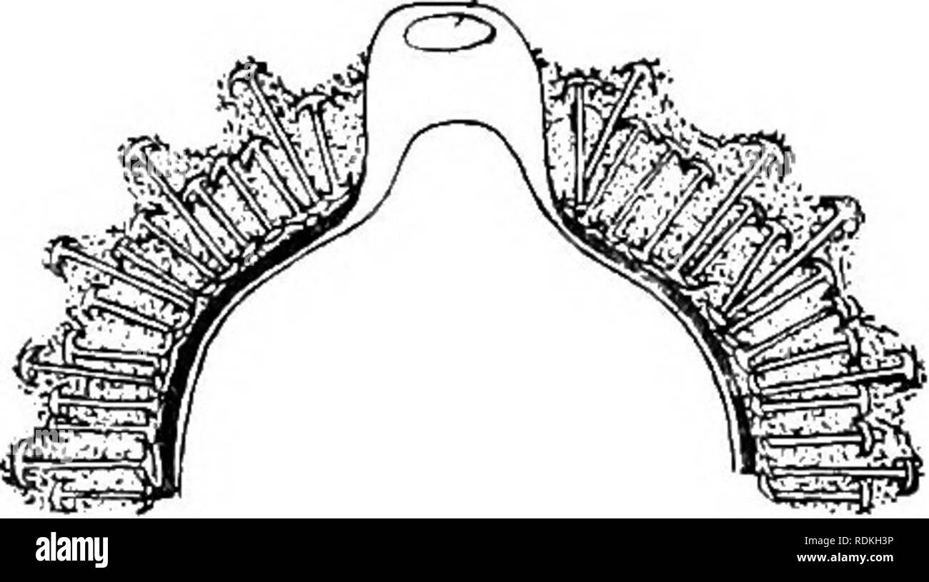 . Die Cambridge Natural History. Zoologie. vii GEMMULES von EPHYDA TIA ICH 79 Die Reife gemmviles bestehen aus einem mehr oder weniger kugelförmigen Masse von Zellen, wliich Wir beziehen, wie Eigelb Zellen und einer komplexen Auftragen. Tlie letztere ist mit einer Pore oder Pore Rohr (Abb. zur Verfügung gestellt. 74), der im Winter durch einen organischen Membran geschlossen. Es gibt drei Schichten im Wappen: Eine innere chitinous Layers, der durch ein Luft-kammer Schicht umgeben, ist fein wliich Vesikuläre, zeigt eine Struktur erinnert an pflanzlichen Gewebe und Con-Das amphidiscs zusammen Radien, die durch die Mitte des gemmule. Eine der Scheiben von Stockfoto