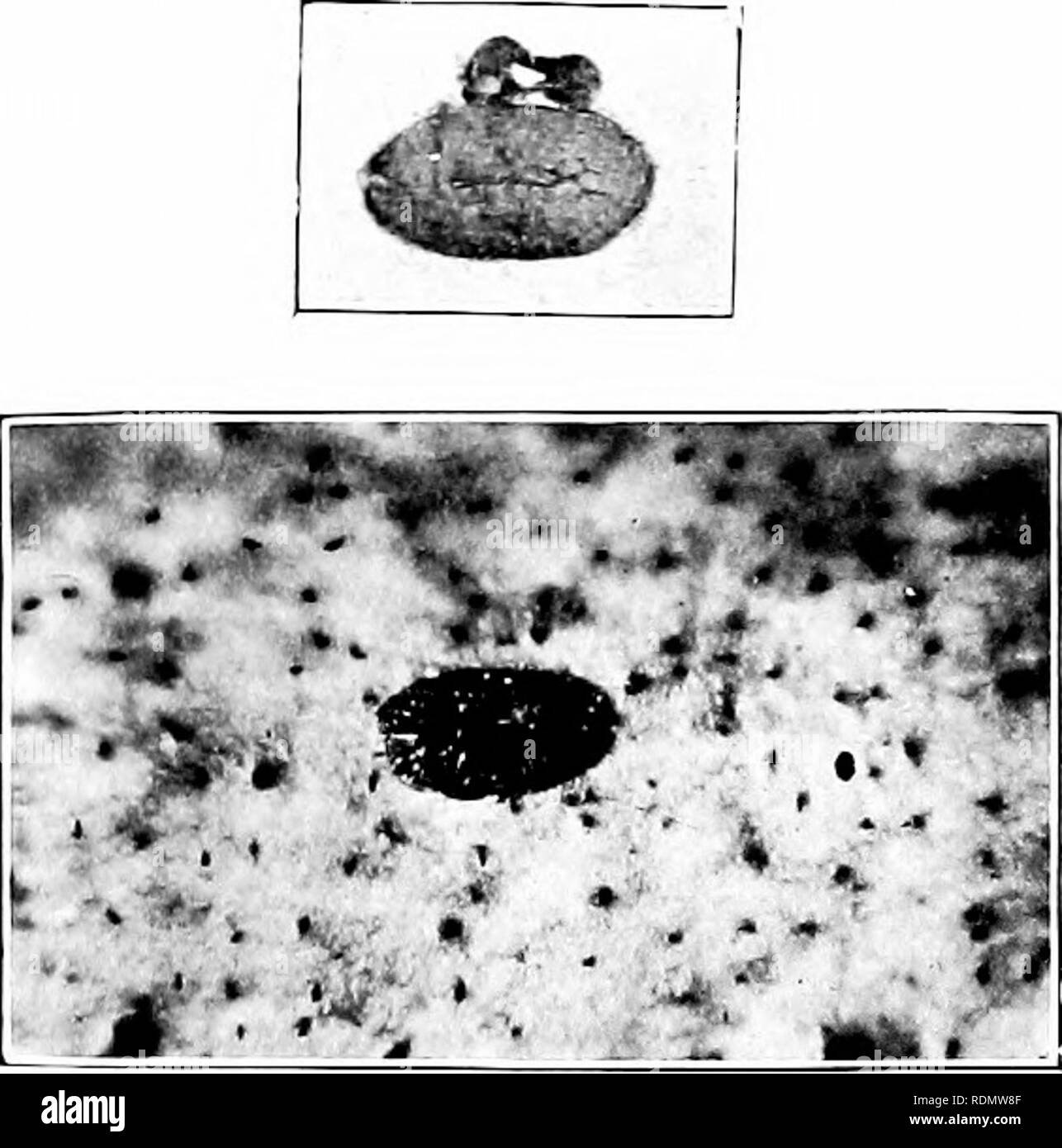 . Das Insekt und anderen alliierten Schädlinge der Obstgarten, Bush und Treibhaus Früchte und ihre Prävention und Behandlung. Schädlinge; Obst. 228 Schadinsekten. tlie liatched in der ersten Woche in. Tudc und Ga-e Lise zu reifen Frauen im August, die Eier, die Sie im September liatclied hinterlegt. Die Mehrheit dieser komplett entwickelt Frauen liy tlu' 20 Octolier, und aus der e.sgs festgelegt. l. iy Diese es Larve" entsprungen, whicli ich auch auf der Imshes in Xovendjer gefunden. Es scheint daher tiiat in Kent, und wahrscheinlich irgendwo, kann es bis zu drei Ije lu 'dÖle dieses Coccid, aber normalerweise gibt es Stockfoto