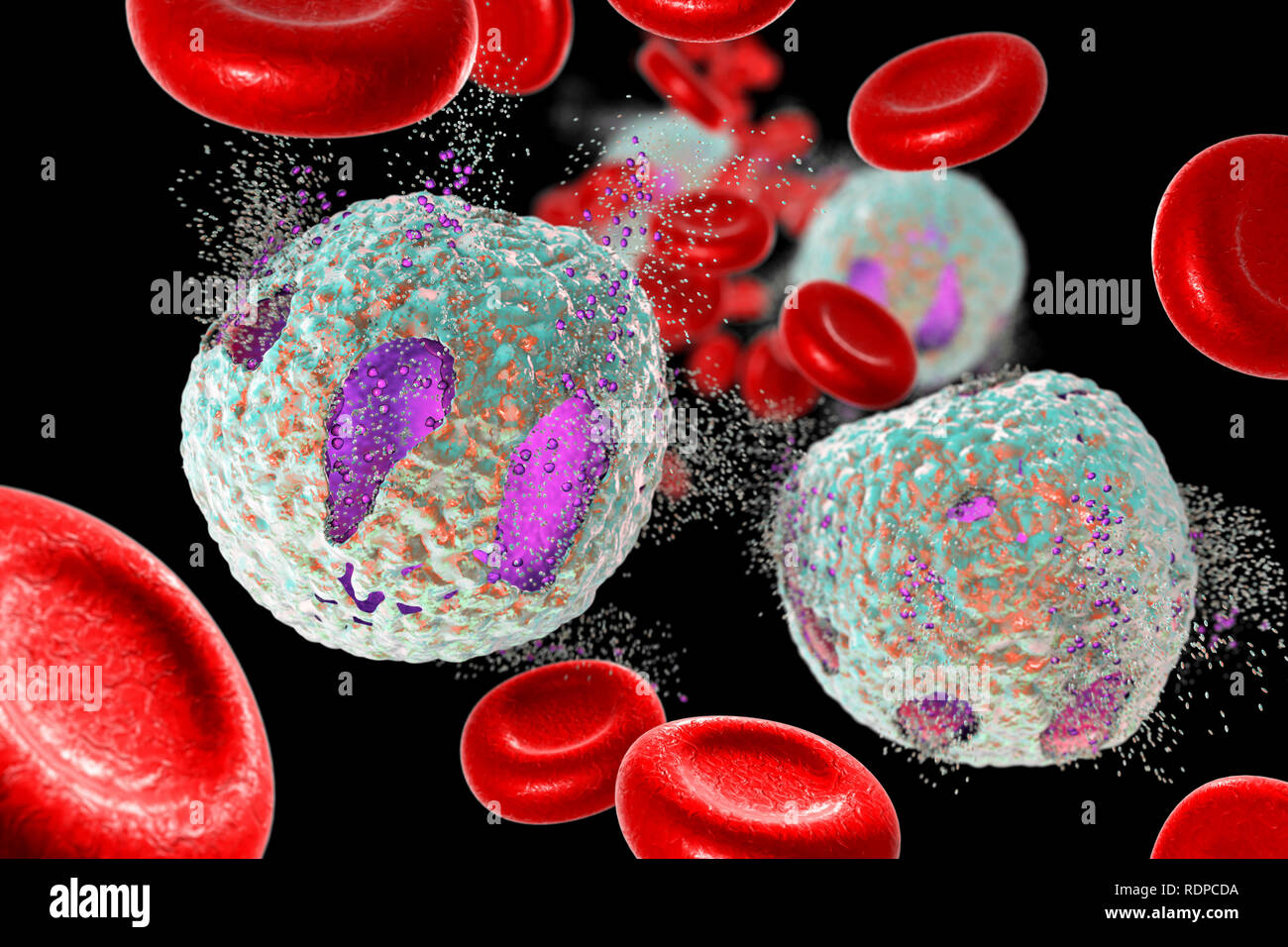 Akute lymphoblastische Leukämie Behandlungskonzept. Computer Abbildung: Zerstörung von Lymphoblast Zellen. Stockfoto