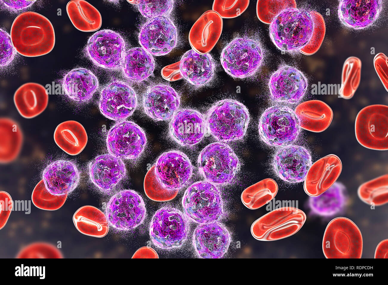 Akute lymphoblastische Leukämie Behandlungskonzept. Computer Abbildung: Zerstörung von Lymphoblast Zellen. Stockfoto