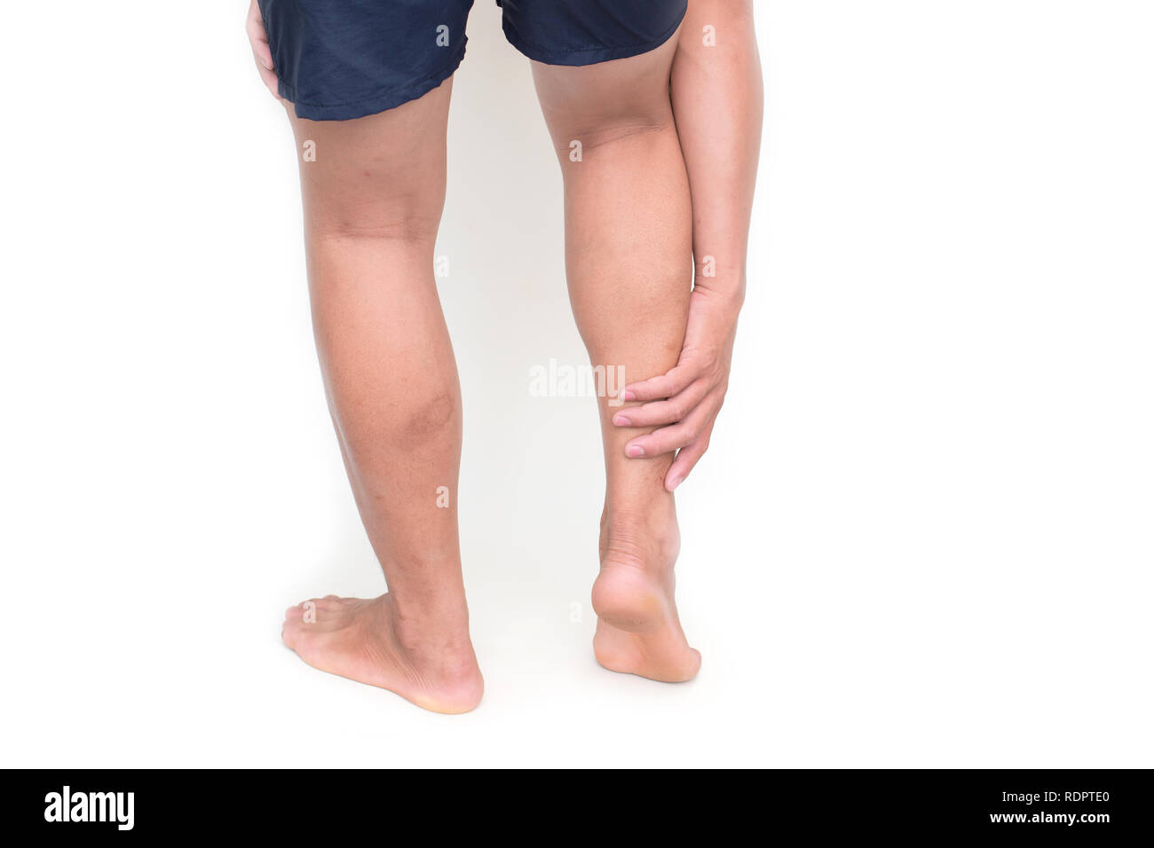 Junge Menschen leiden unter Schmerzen im Bein auf weißem Hintergrund Stockfoto