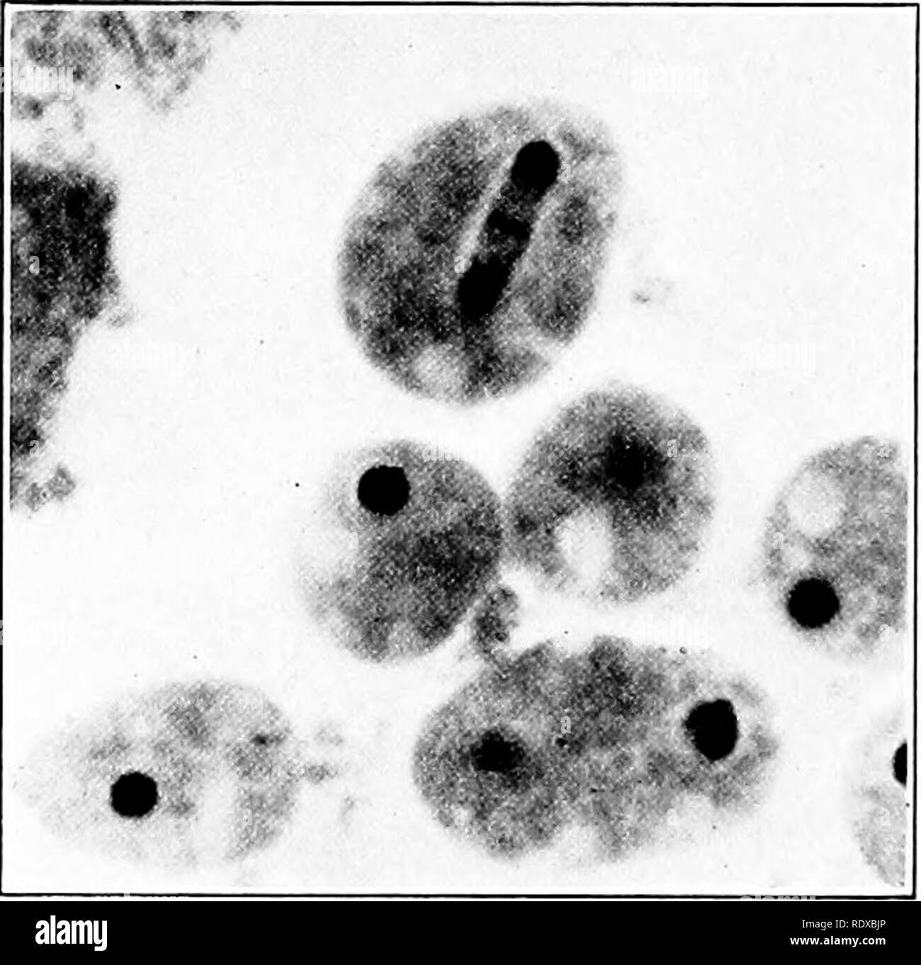. Protozoo?. Protozoen; Protozoen, Pathogenen. 140 Konjugation, Reifung und Befruchtung germ Atomkerne. Aber i.e. die einfachste Form solche Komplikation ist nicht appar-ent, für die idiochromidia in Massen ohne Kernenergie Wände getrennt wird, und diese Massen Sicherung. Dies ist der Fall in Amöben Umax, einem kleinen frei lebende Amöben in Teichen oder verfallende Angelegenheit gemeinsamen. Es kann leicht auf künstliche Kultur Medien wie Agar kultiviert werden, in Verbindung mit verschiedenen Arten von Bakterien als Nahrung dienen. Unter normalen Bedingungen von Temperatur, Salzgehalt usw., die amebfe reproduzieren durch einfache Division und Stockfoto