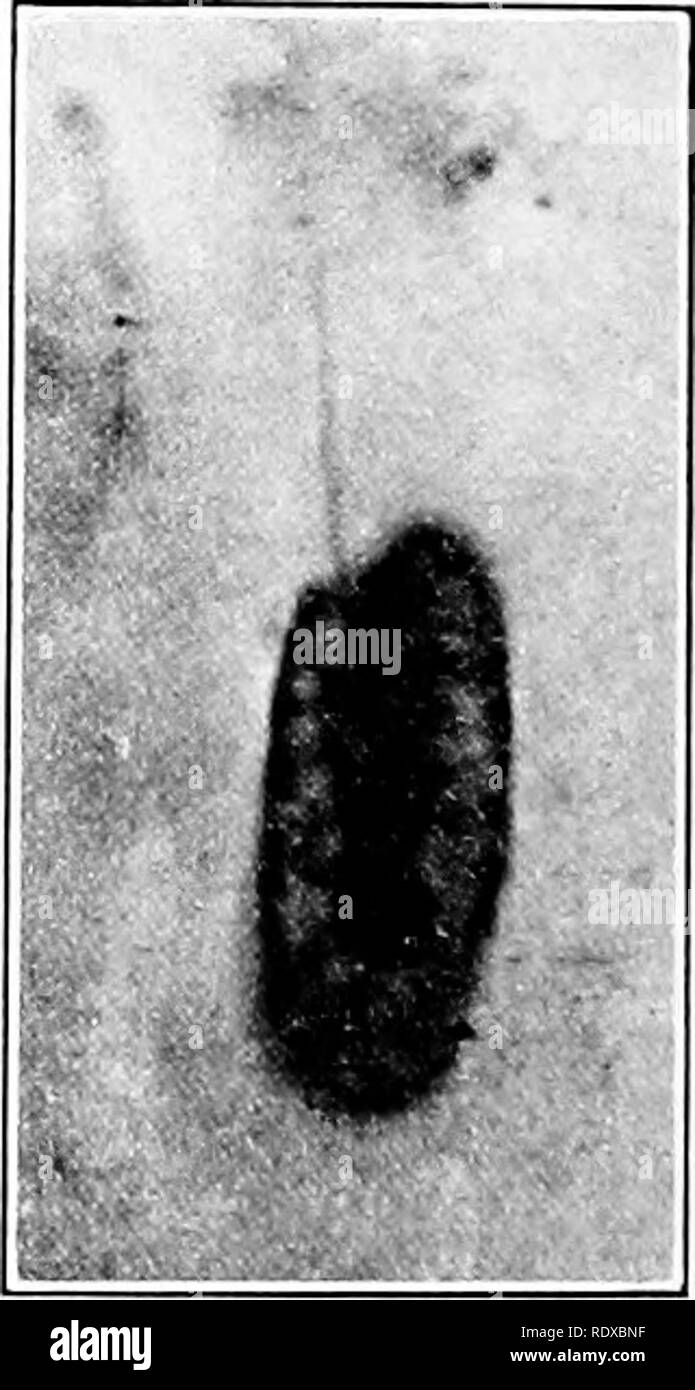 . Protozoo?. Protozoen; Protozoen, Pathogenen. Ameba Umax (Gruppe von fünf auf der linken Seite) und Chilomonas Paramecium alveolarer Struktur der protoijlasni vor idiochromidia Bildung zu zeigen. Zwei der aiuebae sind im Prozess der Di'ision. Verschiedene, in Grad zu speichern, klicken Sie auf die dritte, die ich nukleare Fragmentierung bezeichnet haben. Die unterscheidungen haben, am besten, nur Ein beschreibender Wert. Atomare Auflösung, in der Substanz, wurde vor mehr als dreißig Jahren durch Hertwig ('76) in Verbindung mit der radiolarie kann beschrieben - thometra. In dieser Form gibt es eine große Zunahme in der Dicke des Chromatins bei t Stockfoto